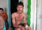 Tragis! Remaja di Deli Serdang Dianiaya dan Dibakar, Diduga Pelakunya Oknum PNS
