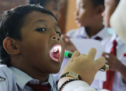 Waspada! Ini Makanan dan Minuman yang Perlu Dibatasi demi Gigi Sehat